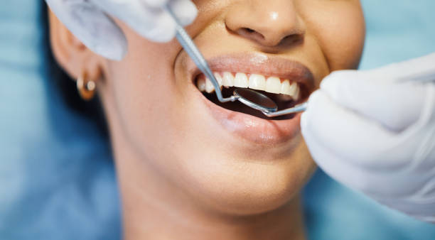 Best Broken or Cracked Tooth Emergency Dentist in Big River, CA