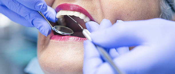Best Emergency Dentist for Knocked-Out Tooth in Big River, CA