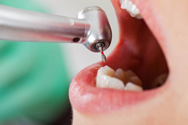 Best Emergency Dental Care for Abscessed Tooth in Big River, CA